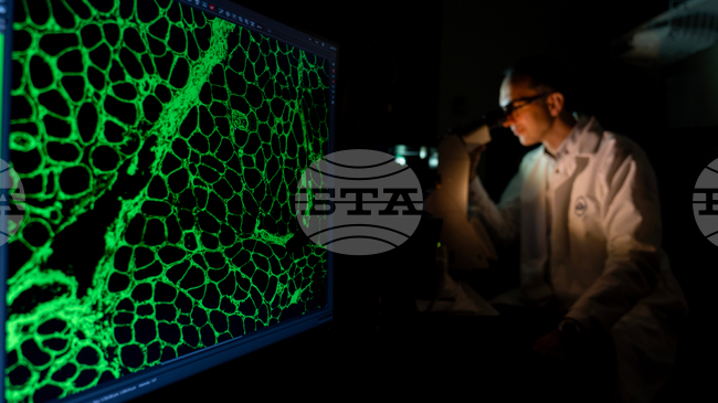 Човешкото сърце може да възстанови мускулни клетки след сърдечен удар, сочи проучване