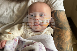 Infant Formula Botulism Recall