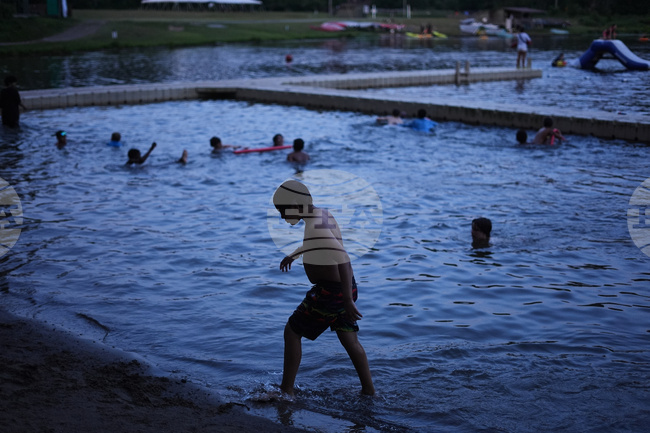 Autoimmune Diseases Children