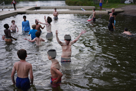 Autoimmune Diseases Children Photo Essay