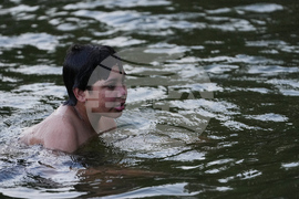 Autoimmune Diseases Children Photo Essay