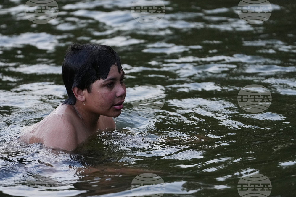 Autoimmune Diseases Children Photo Essay