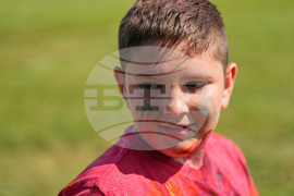 Autoimmune Diseases Children Photo Essay