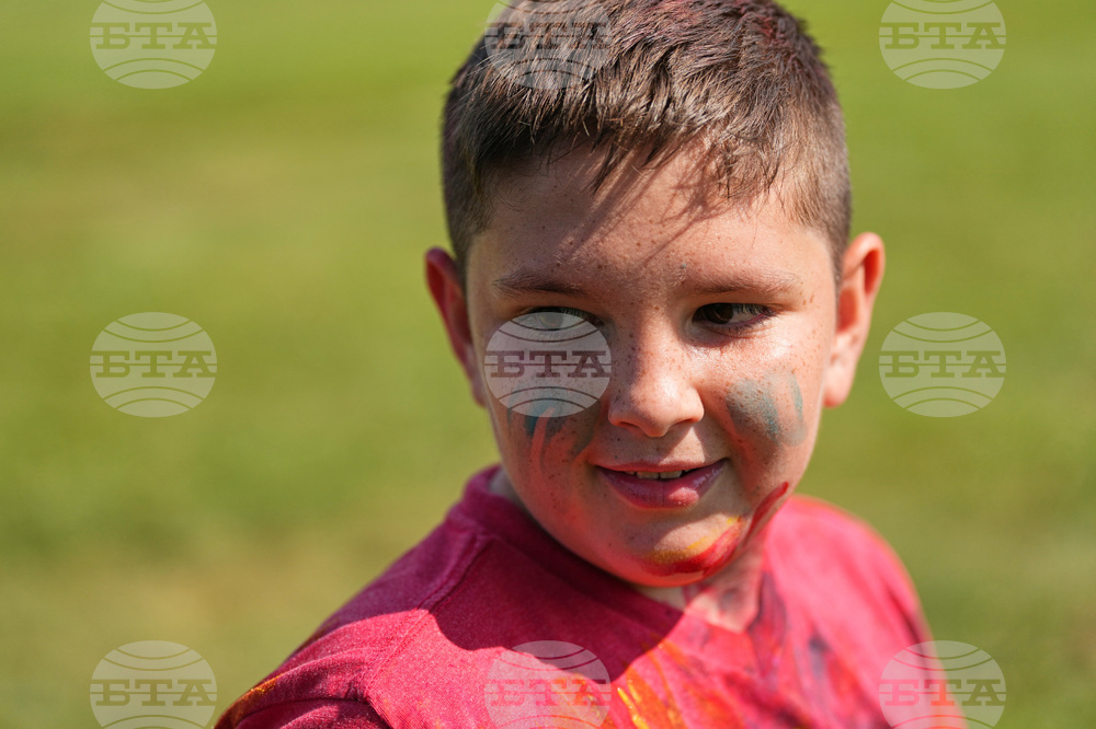 Autoimmune Diseases Children Photo Essay