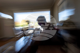 Autoimmune Diseases Brain Photo Essay