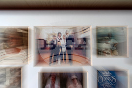 Autoimmune Diseases Brain Photo Essay