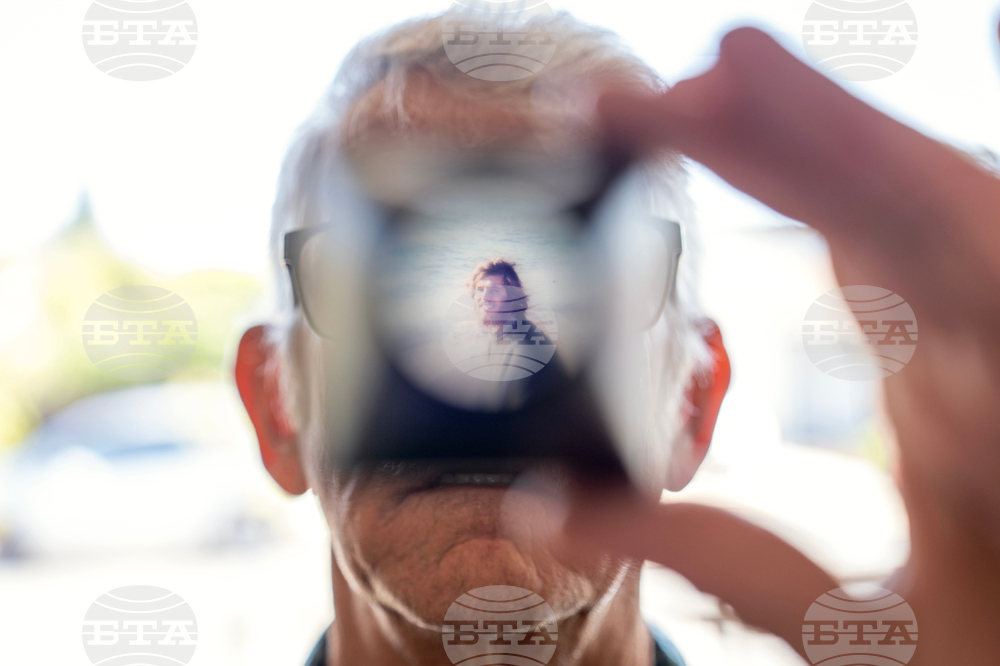 Autoimmune Diseases Brain