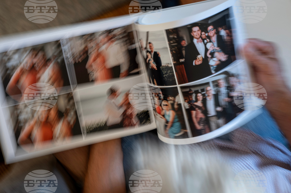 Autoimmune Diseases Brain Photo Essay