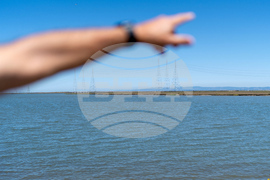 Autoimmune Diseases Brain Photo Essay