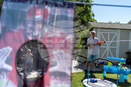 Autoimmune Diseases Brain Photo Essay