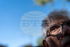 Autoimmune Diseases Brain Photo Essay