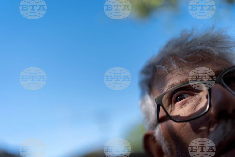 Autoimmune Diseases Brain Photo Essay