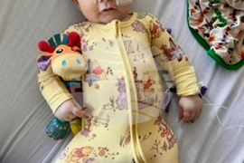 Infant Formula-Botulism Recall