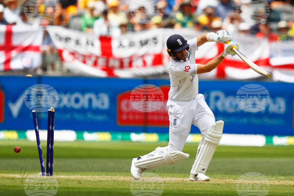 APTOPIX Australia England Cricket