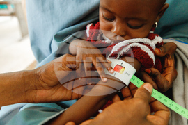 APTOPIX Nigeria Food Insecurity