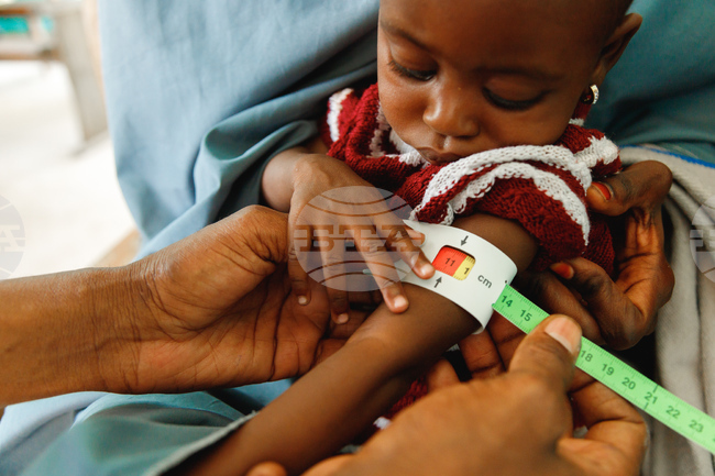 APTOPIX Nigeria Food Insecurity