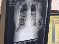 Перник - болница - внедряване на изкуствен интелект