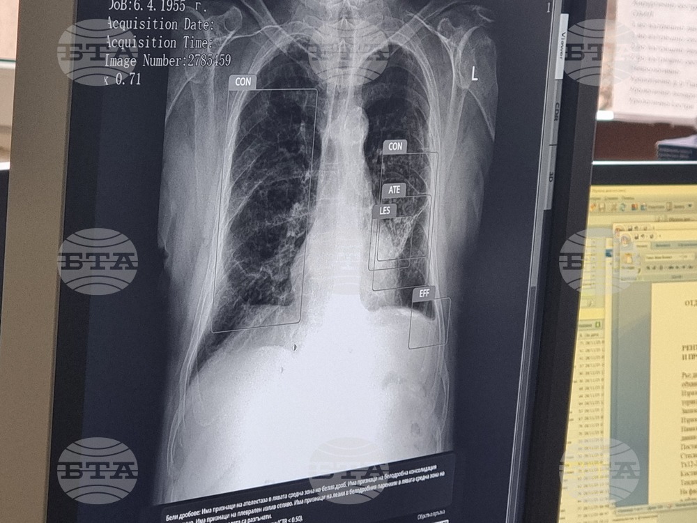 Перник - болница - внедряване на изкуствен интелект