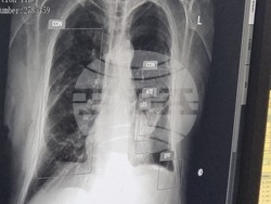 Перник - болница - внедряване на изкуствен интелект