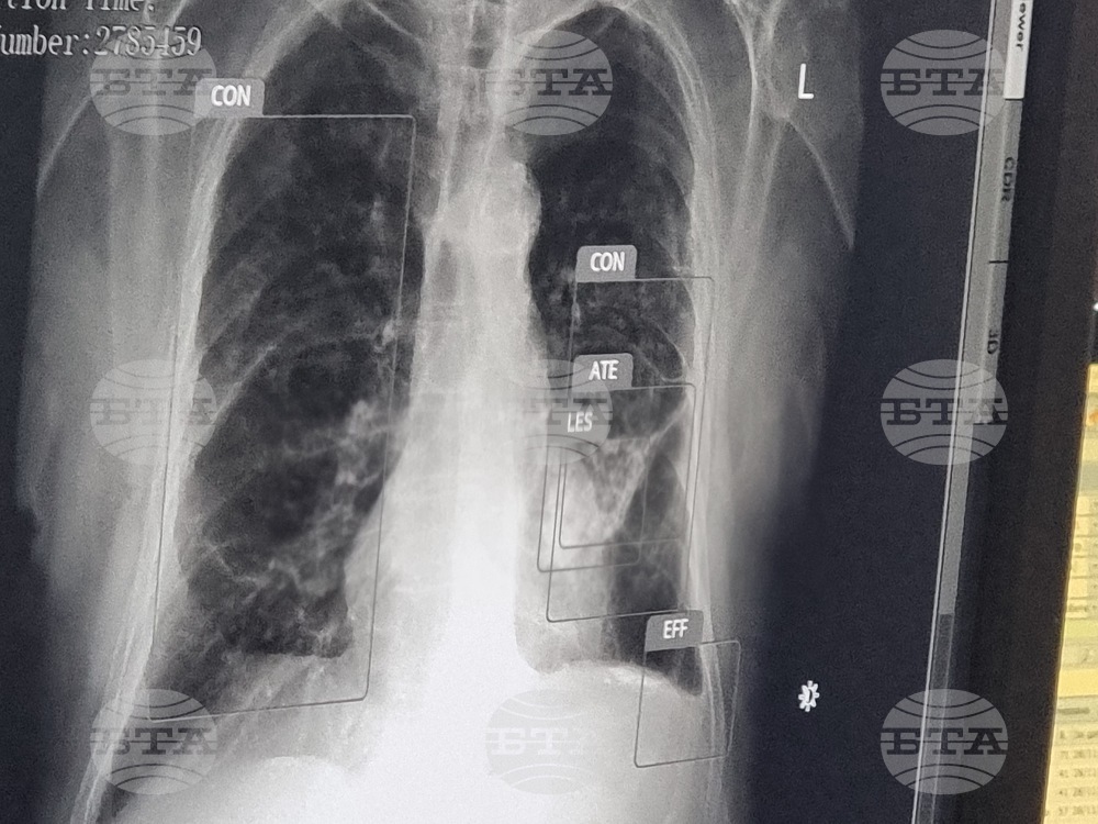 Перник - болница - внедряване на изкуствен интелект