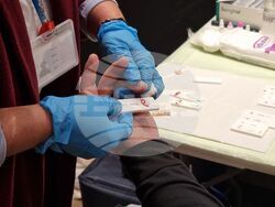 Ямбол - безплатно тестване за СПИН, хепатит В и С и сифилис