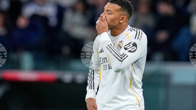 Мбапе си счупи пръста на ръката, но ще играе срещу Манчестър Сити в Шампионската лига