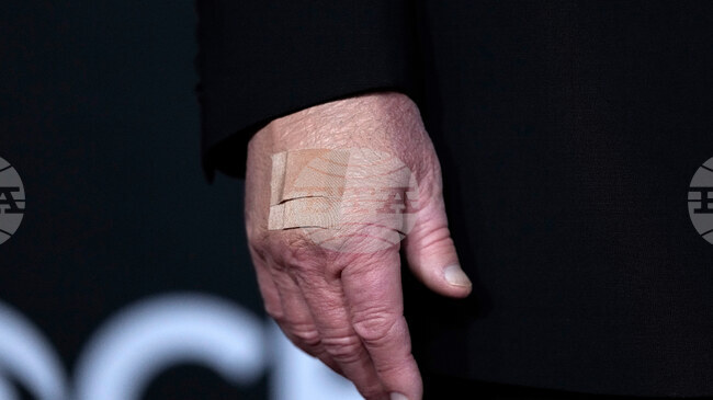 Изследователи са разработили „интелигентна“ превръзка за наблюдение и лечение на рани