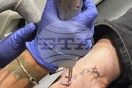 Be Well Tattoo Removal