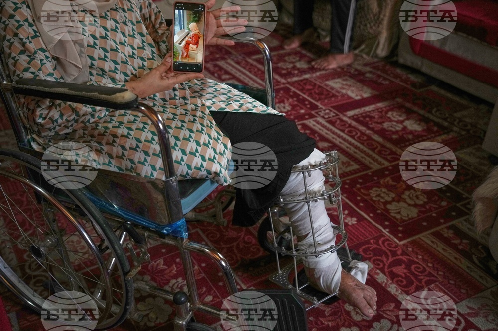 Mideast Wars Gaza Amputees