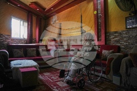 Mideast Wars Gaza Amputees