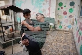 APTOPIX Mideast Wars Gaza Amputees