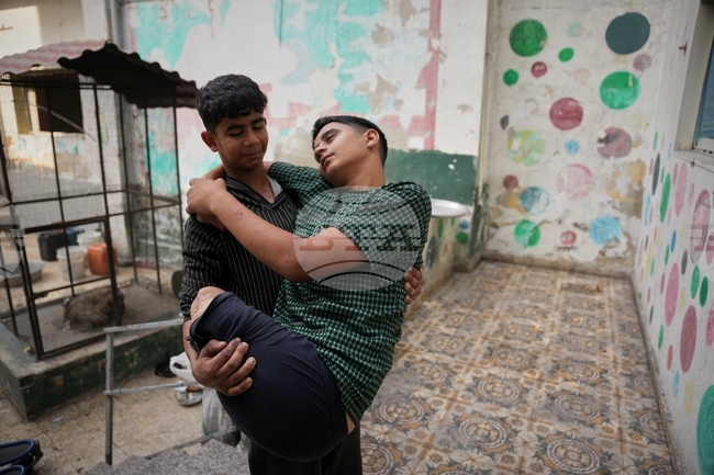 APTOPIX Mideast Wars Gaza Amputees