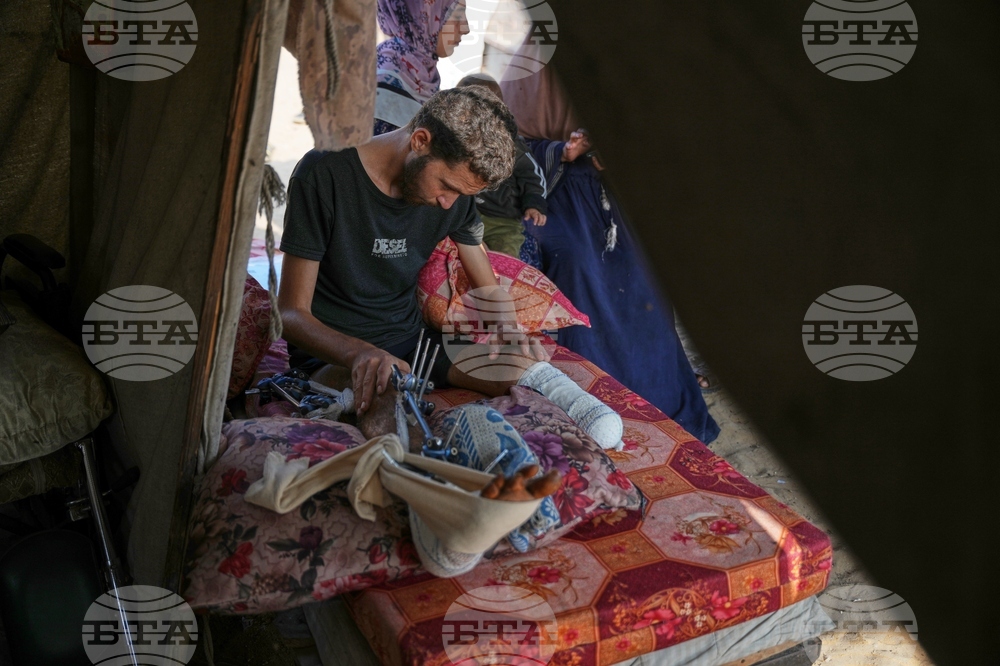 Mideast Wars Gaza Amputees