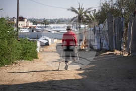 Mideast Wars Gaza Amputees