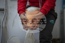 Mideast Wars Gaza Amputees