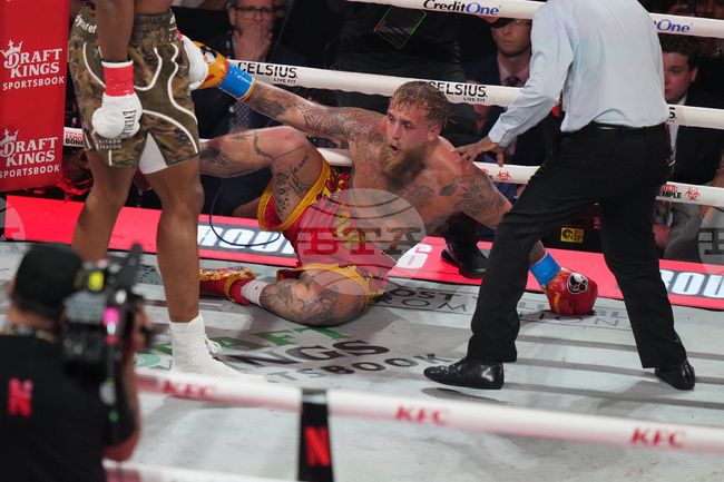 Джейк Пол е с две фрактури на брадата след мача с Антъни Джошуа