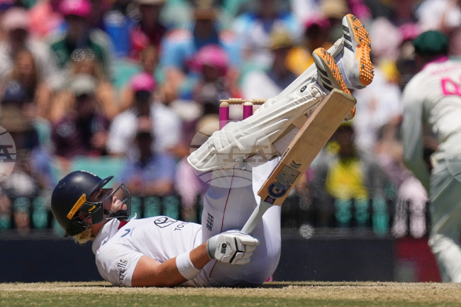 APTOPIX Australia England Cricket