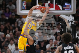 APTOPIX Lakers Spurs Basketball