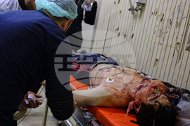 Syria Aleppo Clashes