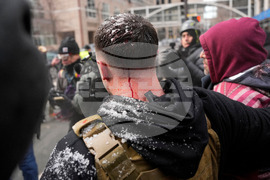 Immigration Enforcement Minnesota