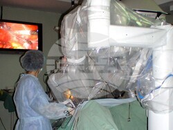 Плевен - Университетска болница - онкоцентър - операция - Да Винчи - робот 