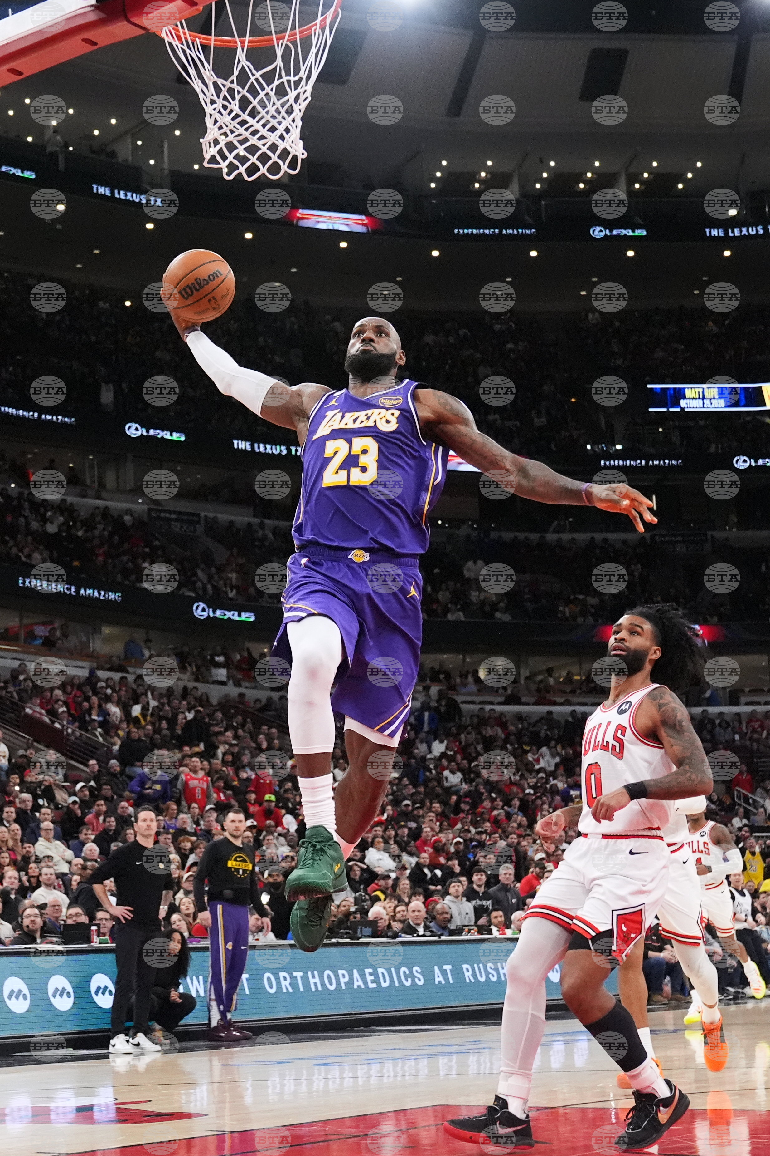 APTOPIX Lakers Bulls Basketball