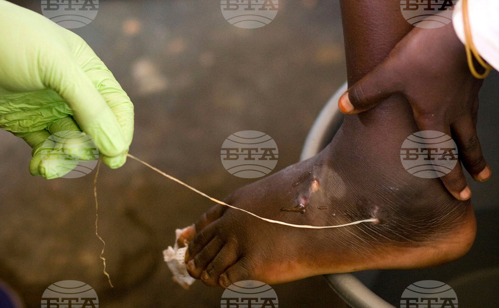 Carter-Guinea-Worm