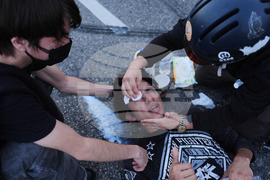 APTOPIX Immigration Enforcement California Protests