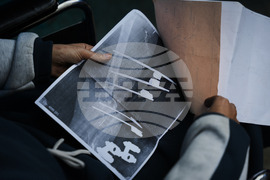 Mideast Wars Gaza Patients