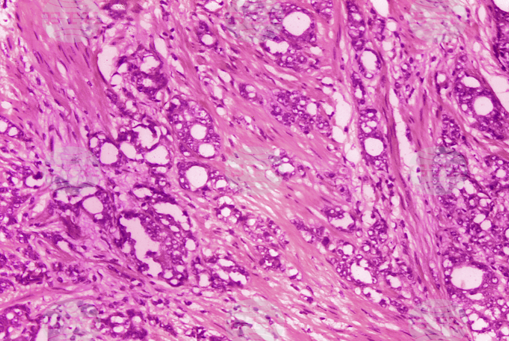 Учени създадоха роботи за борба с рака под формата на микромехурчета