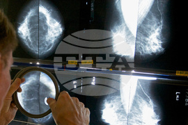 Pandemic Cancer Deaths