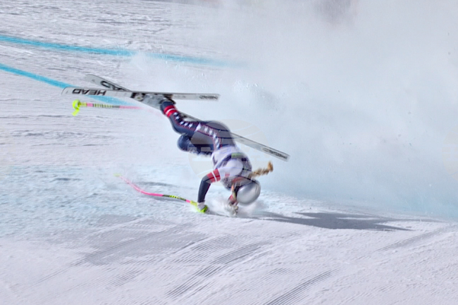 Линдзи Вон претърпя нова операция и в близките дни ще се прибере у дома