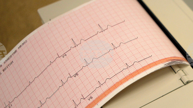 Учени са разработили „умна“ тениска, която открива скрити сърдечни заболявания