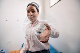 Zimbabwe New HIV Drug